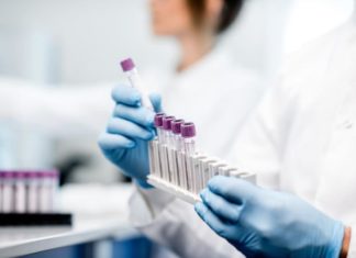 Coronavirus, 38 (36 nella nostra provincia) i contagi