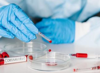 Testati 4137 tamponi. Scende (finalmente) in modo deciso la percentuale di positivi tra test eseguiti e nuovi casi