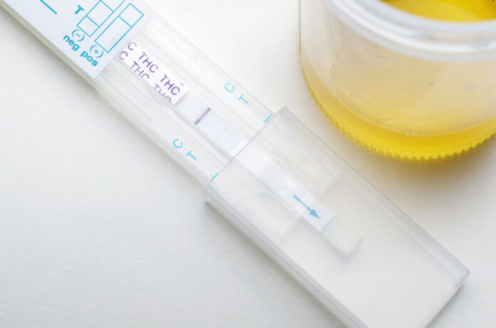 test-antidroga
